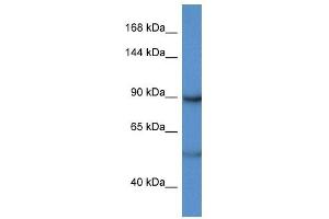 Western Blot showing LPIN2 antibody used at a concentration of 1 ug/ml against Hela Cell Lysate (Lipin 2 antibody  (C-Term))
