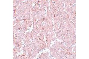Immunohistochemical staining of rat liver tissue with NR1H3 polyclonal antibody  at 5 ug/mL dilution. (NR1H3 antibody  (N-Term))