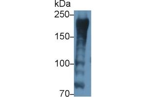 Detection of AKAP12 in Porcine Skeletal muscle lysate using Polyclonal Antibody to A Kinase Anchor Protein 12 (AKAP12) (AKAP12 antibody  (AA 1485-1782))