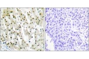 Immunohistochemistry (IHC) image for anti-Heterogeneous Nuclear Ribonucleoprotein A1 (HNRNPA1) (AA 51-100) antibody (ABIN1533600)
