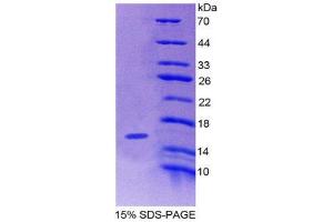SDS-PAGE (SDS) image for Pre-B Lymphocyte 1 (VPREB1) (AA 33-135) protein (His tag) (ABIN2126390) (VPREB1 Protein (AA 33-135) (His tag))