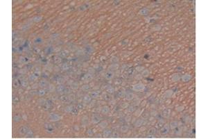 IHC-P analysis of Rat Brain Tissue, with DAB staining. (MAPT antibody  (AA 34-368))
