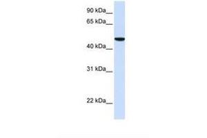 Image no. 1 for anti-Solute Carrier Family 2 (Facilitated Glucose Transporter), Member 6 (SLC2A6) (AA 38-87) antibody (ABIN6738102) (SLC2A6 antibody  (AA 38-87))