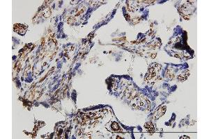 Immunoperoxidase of monoclonal antibody to DKK1 on formalin-fixed paraffin-embedded human placenta. (DKK1 antibody  (AA 1-266))