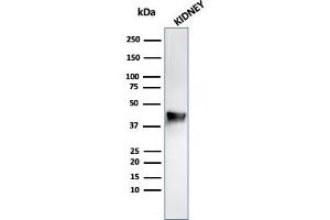 Western Blot analysis of Kidney tissue lysate using AMACR Mouse Monoclonal Antibody (AMACR/r1864). (Recombinant AMACR antibody  (AA 297-394))