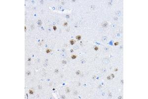 Immunohistochemistry of paraffin-embedded mouse brain using RPP25 Rabbit pAb (ABIN6133248, ABIN6147176, ABIN6147177 and ABIN6225317) at dilution of 1:100 (40x lens). (RPP25 antibody  (AA 1-199))