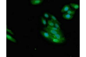 Immunofluorescent analysis of HepG2 cells using ABIN7160778 at dilution of 1:100 and Alexa Fluor 488-congugated AffiniPure Goat Anti-Rabbit IgG(H+L) (NMI antibody  (AA 62-202))