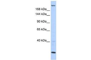 TNRC6B antibody used at 1 ug/ml to detect target protein. (TNRC6B antibody  (N-Term))