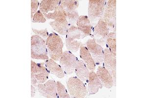 Immunohistochemical analysis of paraffin-embedded H. (SLC25A25 antibody  (N-Term))