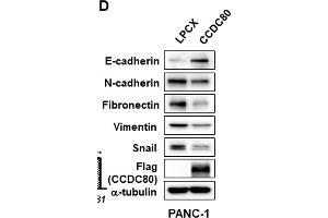 Ectopic expression of CCDC80 reducing migration, colony formation, and EMT in pancreatic cancer cells. (CCDC80 antibody  (AA 201-300))