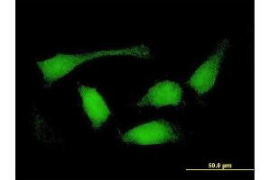 Immunofluorescence of purified MaxPab antibody to FLJ30934 on HeLa cell. (SNX32 antibody  (AA 1-403))