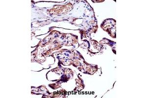 Immunohistochemistry (IHC) image for anti-Neural Precursor Cell Expressed, Developmentally Down-Regulated 9 (NEDD9) antibody (ABIN2998097) (NEDD9 antibody)