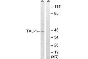 Western blot analysis of extracts from Jurkat cells, treated with PMA (125 ng/mL, 30 mins), using TAL-1 (Ab-122) antibody. (TAL1 antibody  (Ser122))