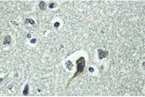 Image no. 2 for anti-Parathyroid Hormone 1 Receptor (PTH1R) antibody (ABIN317698) (PTH1R antibody)