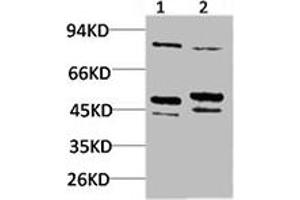 Western blot analysis of 1) Mouse Brain Tissue, 2) Rat Brain Tissue using BEST2 Polyclonal Antibody. (Bestrophin 2 antibody)