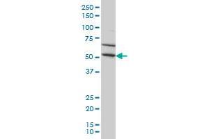 TRIM49 monoclonal antibody (M03), clone 3H8 Western Blot analysis of TRIM49 expression in HeLa . (TRIM49 antibody  (AA 251-340))