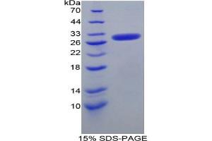 SDS-PAGE analysis of Mouse Nucleoporin 50 kDa Protein.