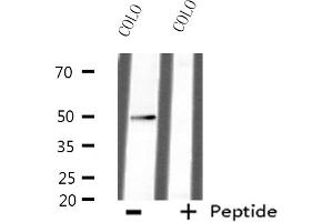 Western blot analysis of extracts from HepG2 cells, using AZI2 antibody. (AZI2 antibody  (N-Term))