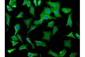 Immunofluorescence staining of SH-SY5Y cells with ABIN7175790 at 1:50, counter-stained with DAPI. (WDR73 antibody  (AA 163-366))