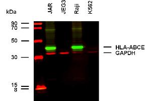 Anti-HLA-ABCE Purified (clone TP25. (HLA-A+B+C+E antibody)