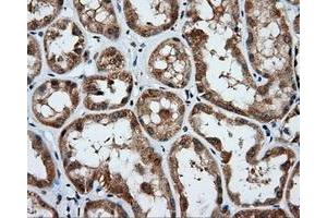 Immunohistochemical staining of paraffin-embedded Kidney tissue using anti-PSMC3 mouse monoclonal antibody. (PSMC3 antibody)