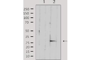 Western blot analysis of extracts from mouse brain, using TFAM Antibody. (TFAM antibody  (Internal Region))