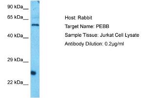 Western Blotting (WB) image for anti-Core-Binding Factor, beta Subunit (CBFB) (N-Term) antibody (ABIN2777178)