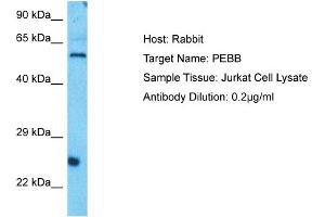 Host: Rabbit Target Name: PEBB Sample Type: Jurkat Whole Cell lysates Antibody Dilution: 0.