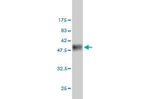Western Blot detection against Immunogen (45. (FMNL2 antibody  (AA 1-178))