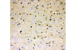 IHC analysis of DDAH1 using anti-DDAH1 antibody (ABIN4886560). (DDAH1 antibody  (C-Term))