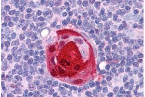 Human Thymus: Formalin-Fixed, Paraffin-Embedded (FFPE) (SMARCA4 antibody  (C-Term))