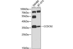 Western blot analysis of extracts of various cell lines, using CCDC92 antibody (ABIN6133294, ABIN6138046, ABIN6138047 and ABIN6224277) at 1:1000 dilution. (CCDC92 antibody  (AA 1-331))