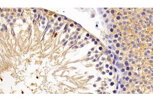Detection of LPIN1 in Rat Testis Tissue using Polyclonal Antibody to Lipin 1 (LPIN1) (Lipin 1 antibody  (AA 729-924))