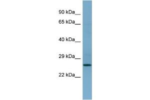 WB Suggested Anti-APIP Antibody Titration: 0. (APIP antibody  (Middle Region))