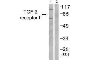 Western Blotting (WB) image for anti-Transforming Growth Factor, beta Receptor II (70/80kDa) (TGFBR2) (Internal Region) antibody (ABIN1848792) (TGFBR2 antibody  (Internal Region))