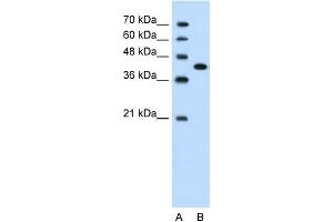 WB Suggested Anti-CEACAM6 Antibody Titration:  1. (CEACAM6 antibody  (Middle Region))