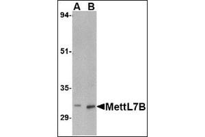 Western blot analysis of MettL7B in rat spleen tissue lysate with this product at (A) 2 and (B) 4 μg/ml.