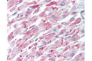 Immunohistochemistry (IHC) image for anti-Amyloid beta (A4) Precursor Protein (APP) antibody (ABIN95037)
