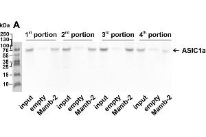 Whole membranes used for the analysis of the molecular targets extracted by mambalgin-2 from membrane fraction of A549 cells. (ASIC1 antibody  (Extracellular Domain))