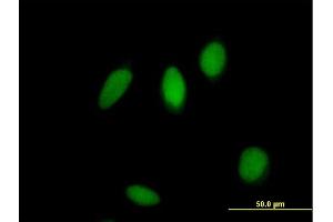 Immunofluorescence of purified MaxPab antibody to ZNF83 on HeLa cell.