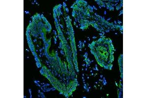 IF analysis of Cytokeratin 19 using anti-Cytokeratin 19 antibody (ABIN3043288). (Cytokeratin 19 antibody  (C-Term))