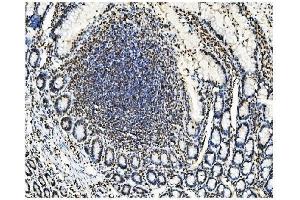 IHC analysis of KAP1/TRIM28 using anti-KAP1/TRIM28 antibody (ABIN7602311).