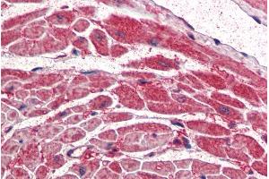 ABIN334459 (5µg/ml) staining of paraffin embedded Human Heart. (PIK3CA antibody  (Internal Region))