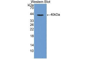 Western blot analysis of the recombinant protein. (CCL3 antibody  (AA 24-92))