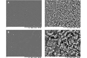 SEM images of the surface of 3D-printed tubular grafts: blank (A), 5 % (w/w) ASA (B), 10 % (w/w) ASA (C), Higher magnification of 10 % (w/w) ASA (D). (Rabbit Blood (In Sodium Citrate))
