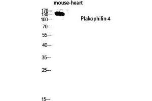 Western Blot (WB) analysis of Mouse Heart lysis using Plakophilin 4 antibody. (Plakophilin 4 antibody  (Internal Region))