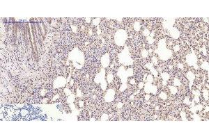 Immunohistochemistry of paraffin-embedded Mouse lung tissue using Desmin Monoclonal Antibody at dilution of 1:200. (Desmin antibody)