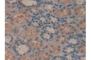 Detection of SYK in Human Kidney Tissue using Polyclonal Antibody to Spleen Tyrosine Kinase (SYK) (SYK antibody  (AA 374-635))