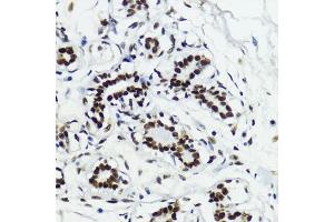Immunohistochemistry of paraffin-embedded human breast using Acetyl-Histone H3-K27 antibody (ABIN7267670) at dilution of 1:200 (40x lens). (Histone 3 antibody  (H3K27))