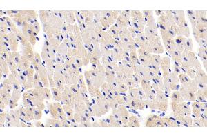 Detection of MYL1 in Human Cardiac Muscle Tissue using Polyclonal Antibody to Myosin Light Chain 1 (MYL1) (MYL1 antibody  (AA 3-142))